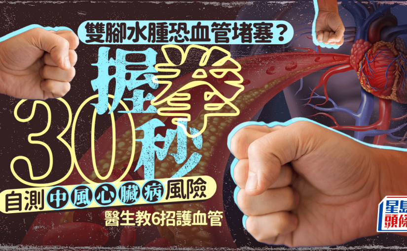 雙腳水腫恐血管堵塞？握拳30秒自測中風/心臟病風險 醫生教6招護血管
