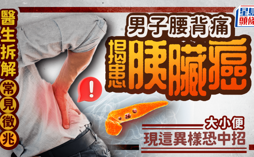 男子腰背痛揭患胰臟癌 醫生拆解常見徵兆 大小便現這異樣恐中招