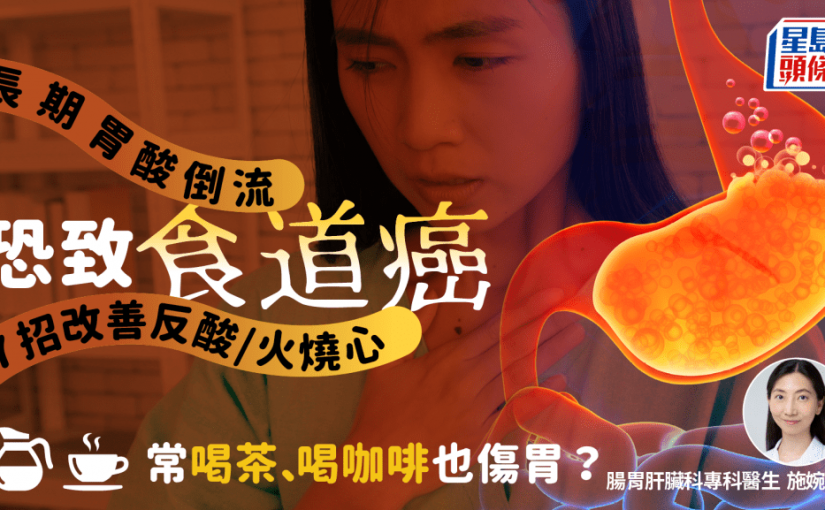 長期胃酸倒流恐灼傷食道致癌 醫生教7招改善反酸/火燒心 常喝茶喝咖啡也傷胃？