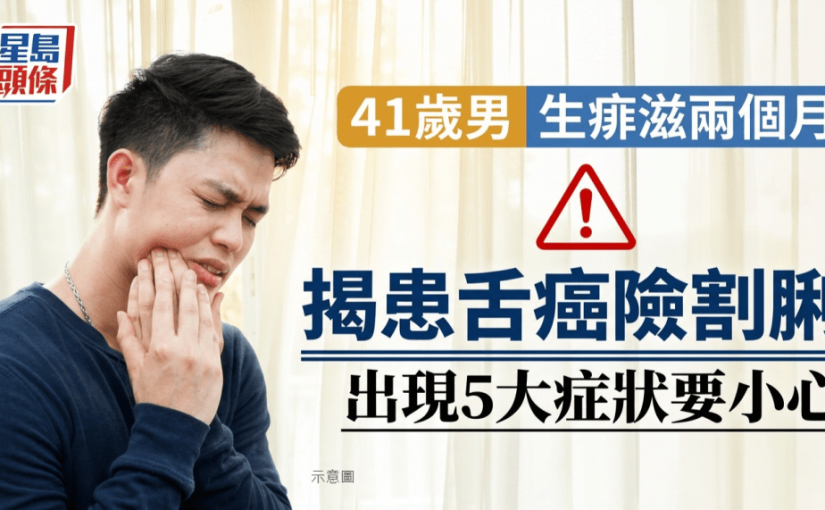41歲男生痱滋兩個月不痛不癢 求醫驚揭患舌癌險割脷 出現5大症狀要小心