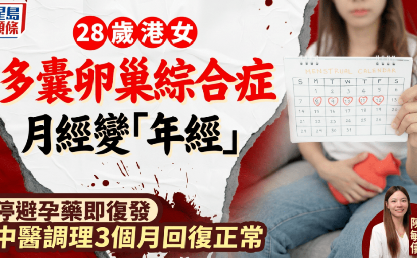 28歲港女多囊卵巢綜合症 月經變「年經」停避孕藥即復發 中醫調理3個月回復正常
