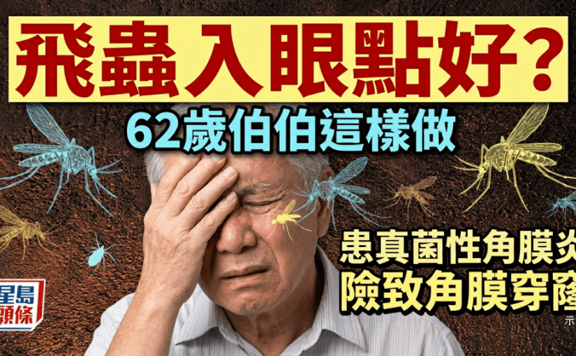 飛蟲入眼點好？62歲伯伯用手這樣做 患真菌性角膜炎險失明
