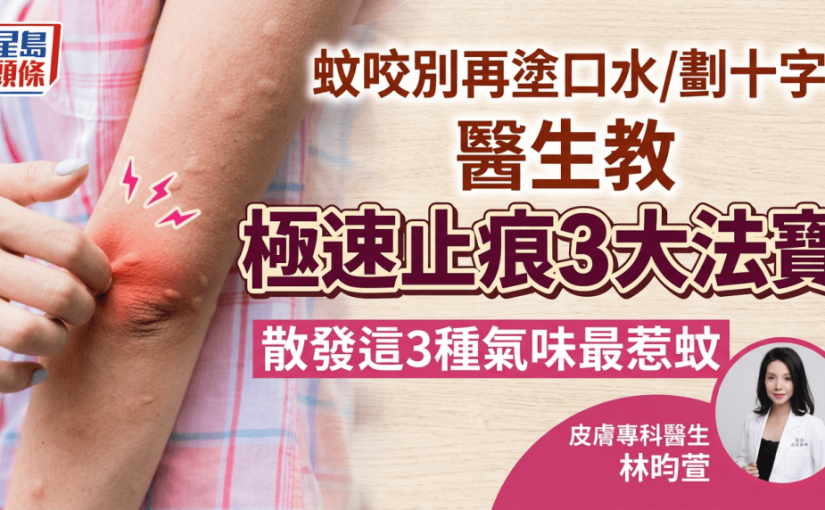 蚊咬別再塗口水/劃十字！醫生教極速止痕3大法寶 散發這3種氣味最惹蚊